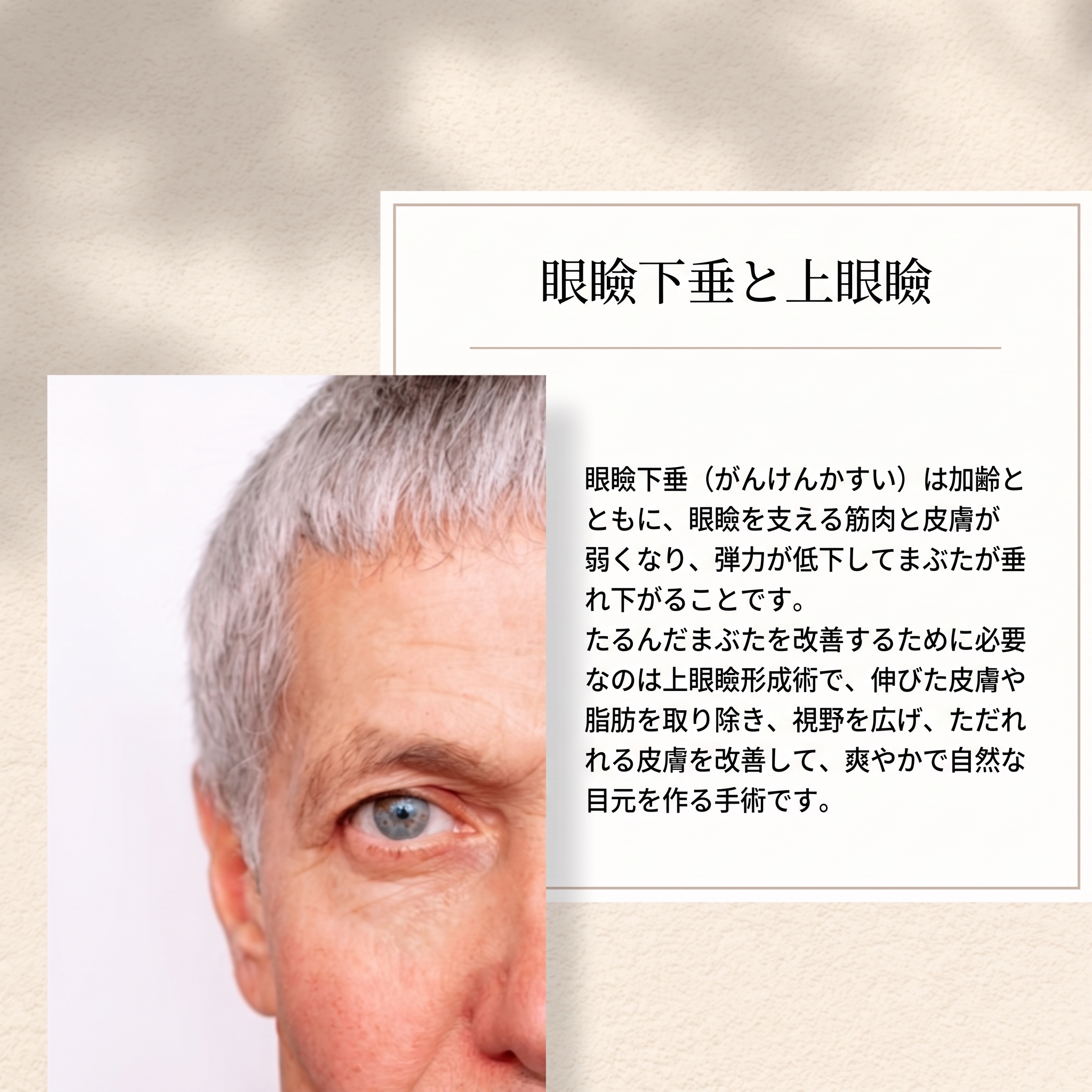 まぶたの痙攣を治すには？清潭洞の目元整形 사진 2