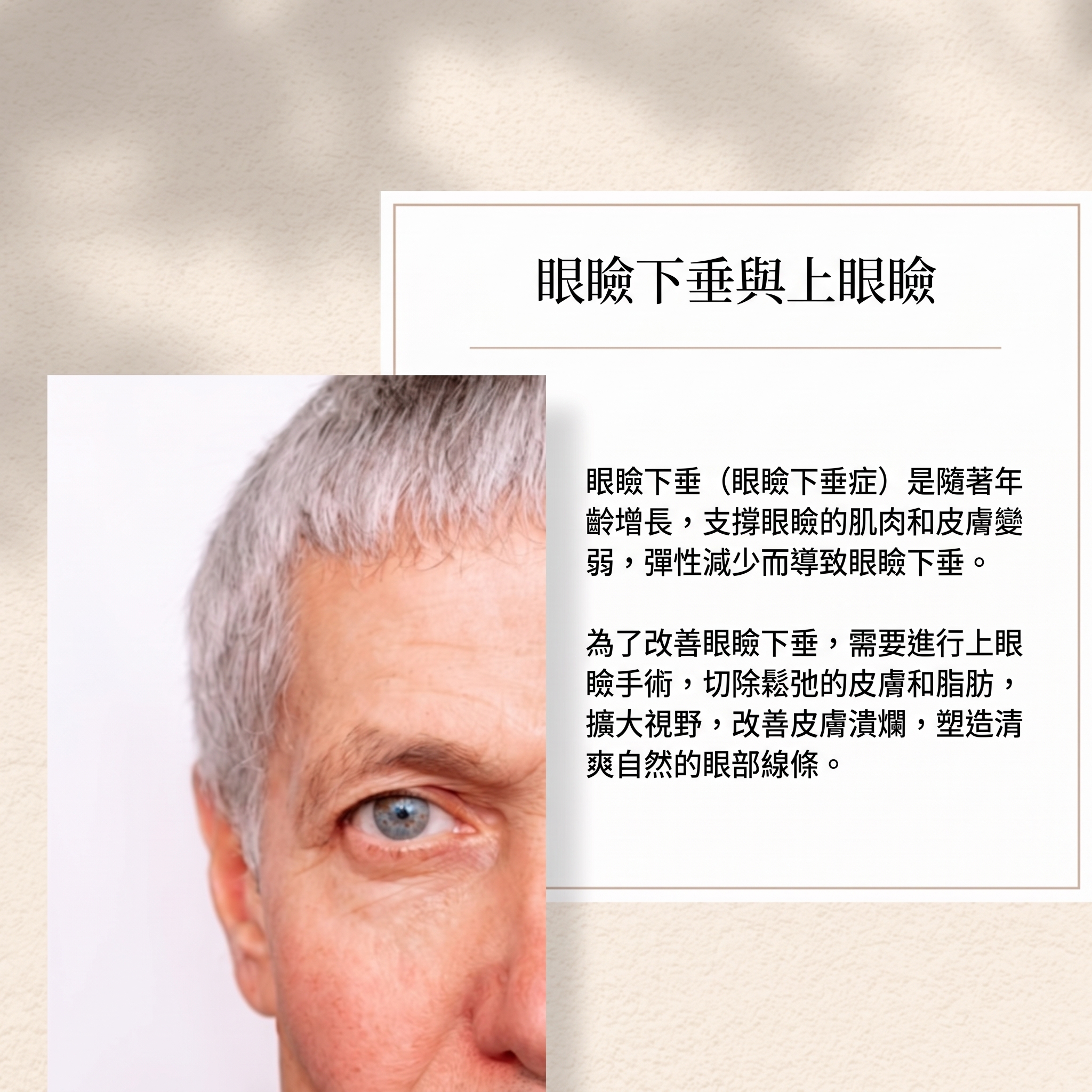 如何矯正眼瞼顫抖現象?清潭洞眼部整形 사진 2