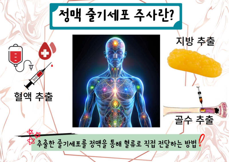 静脉干细胞注射的优缺点