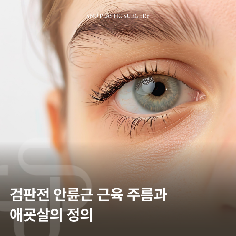 애교살(안륜근 근육주름) 아시아와 서양의 미적기준