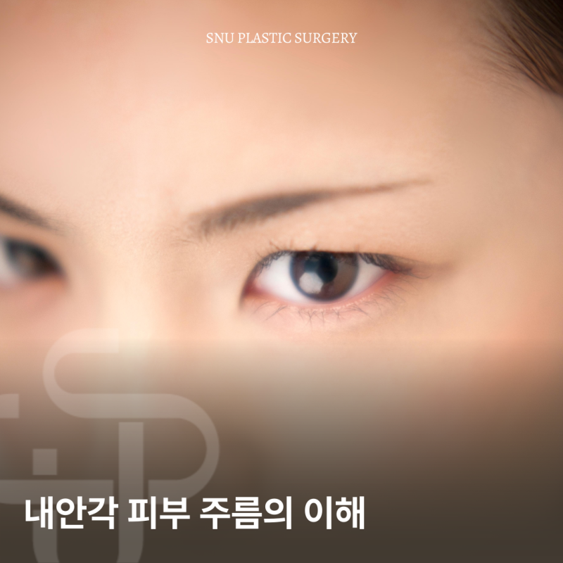 내안각 피부 주름의 생물학적 특성과 앞트임 수술