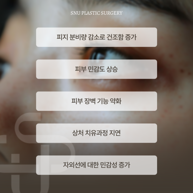 이소트레티노인 복용 중 피부 시술 주의사항