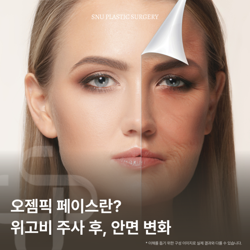 위고비 주사제와 안면 변화, 예방법과 개선 방안