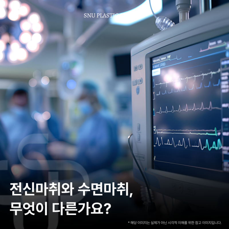 전신마취와 수면마취, 마취 방법별 비교