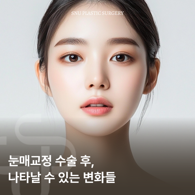 눈매 교정과 '뮬러증후군'