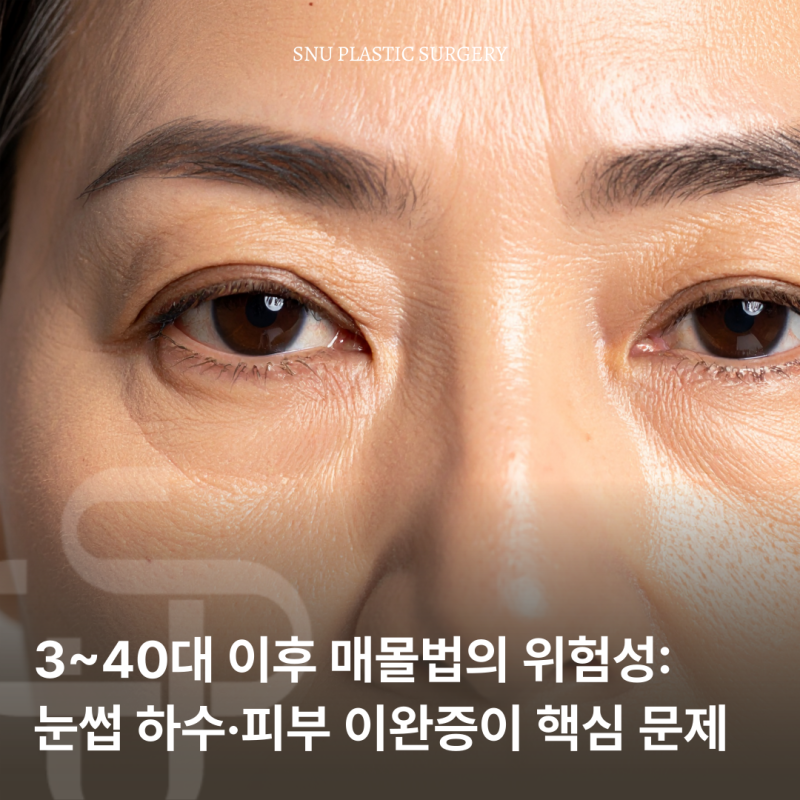 30, 40대 이후 쌍꺼풀 매몰법, 가능할까?