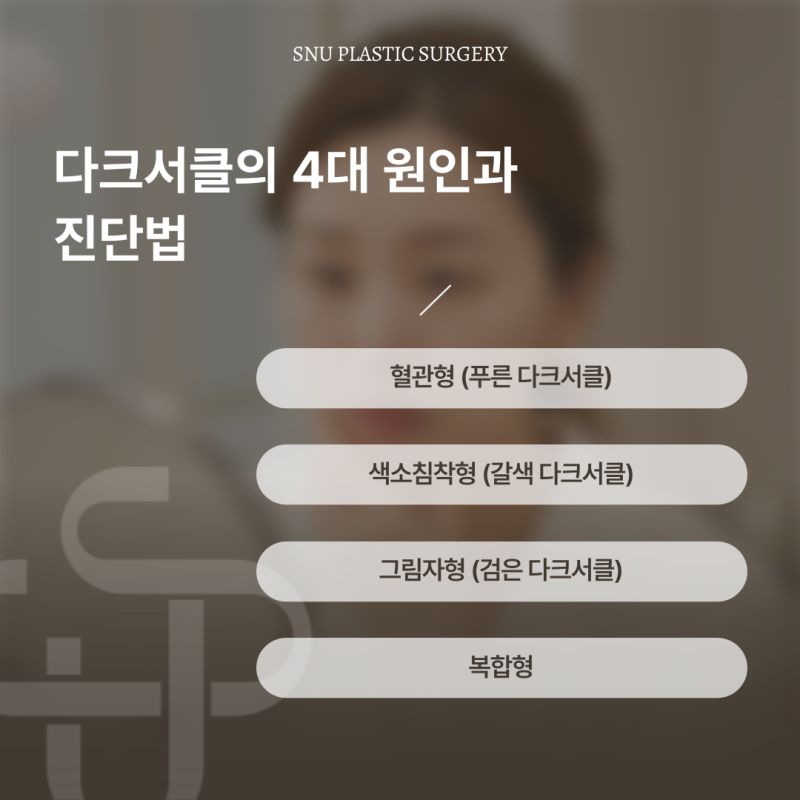 [청담 스누성형외과] 눈밑 다크서클 해결 가이드