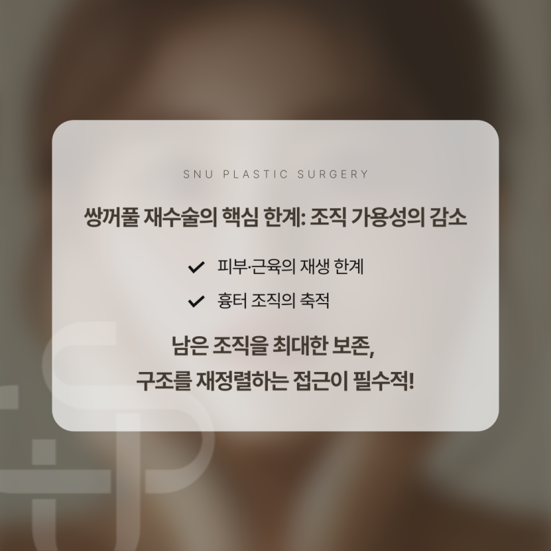 쌍꺼풀 재수술의 한계점과 수술 전략
