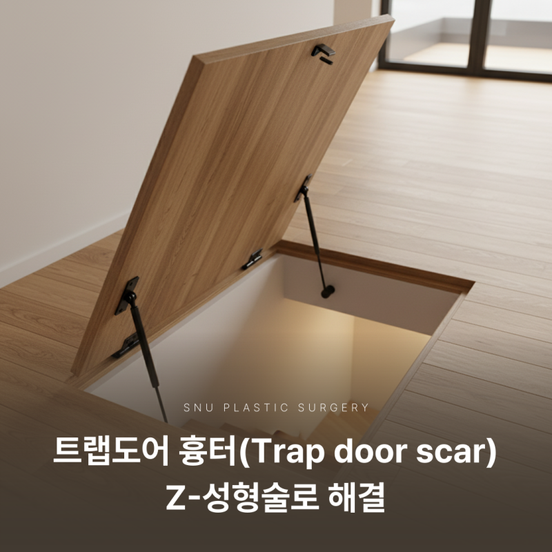[Cheongdam SNU Plastic Surgery] Trapdoor Scar, Solved with Z-Plasty