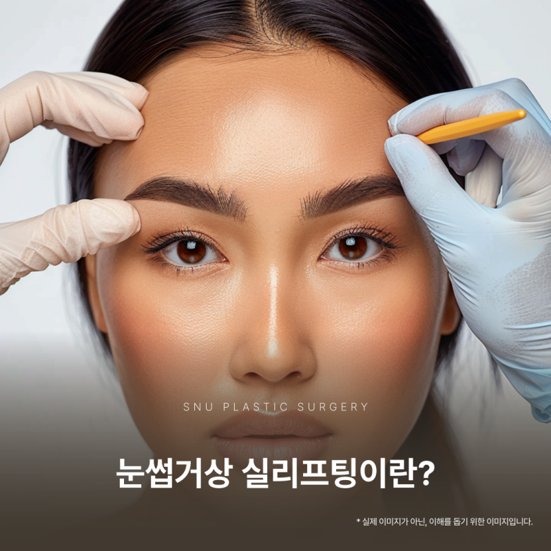 스누성형외과｜눈썹거상 실리프팅으로 처진 눈매를 또렷하게