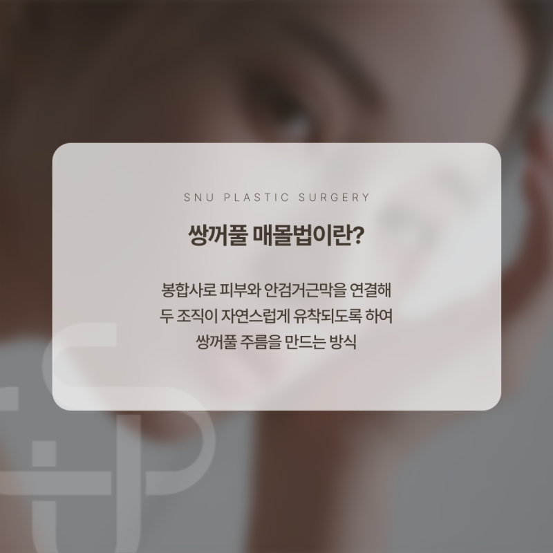쌍꺼풀 매몰법 알고 하자! 가볍게 생각하면 안 되는 이유